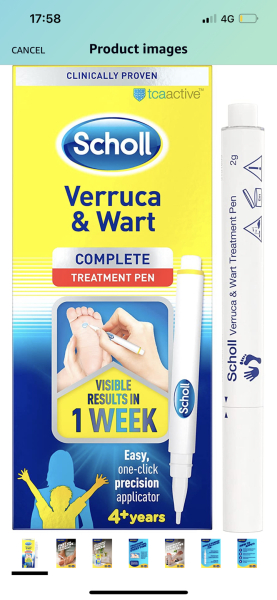 Does this look like I've got rid of the verruca's