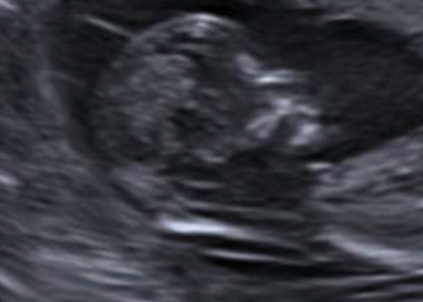 Place your random bets... nub/skull theory! 👶
