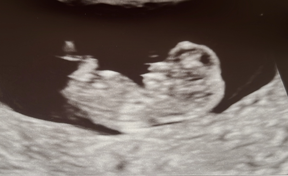 February 2024 Babies 👶 (thread 3)