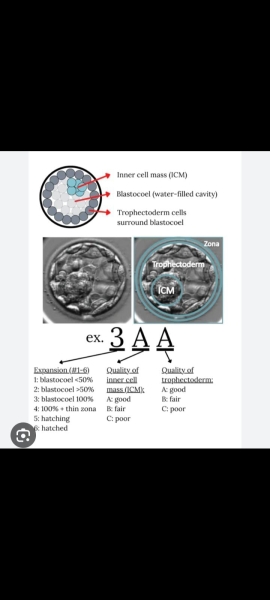 FET / IVF August 2023