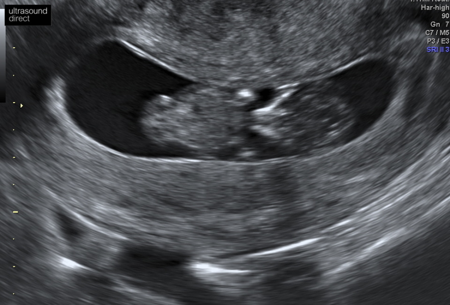 March 2024 continued!