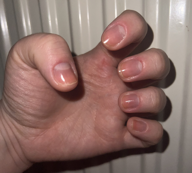 To be so fucking fed up about this *trigger warning- photo*