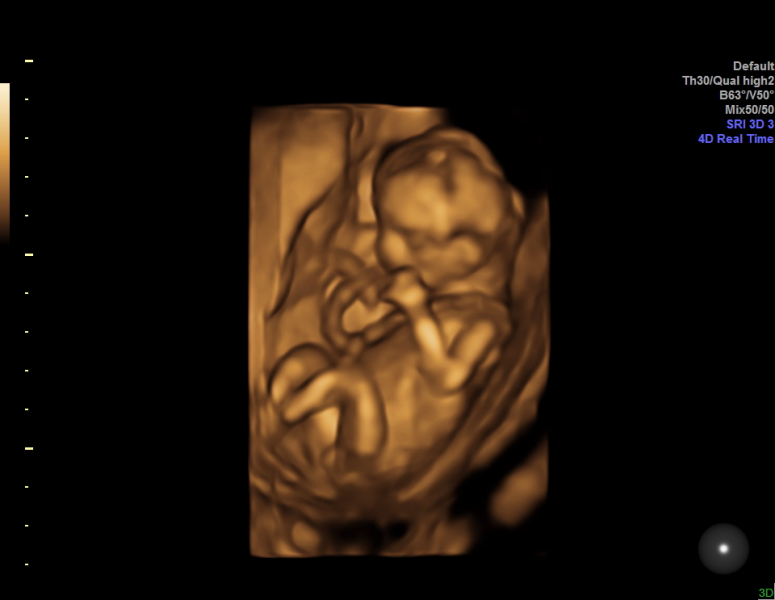 February 2024 Babies 👶 (thread 3)