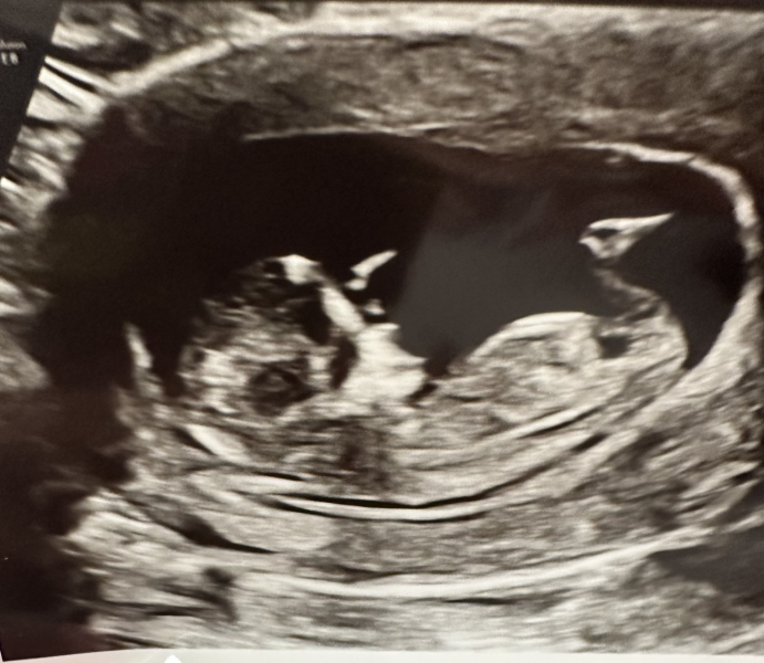 February 2024 Babies 👶 (thread 3)
