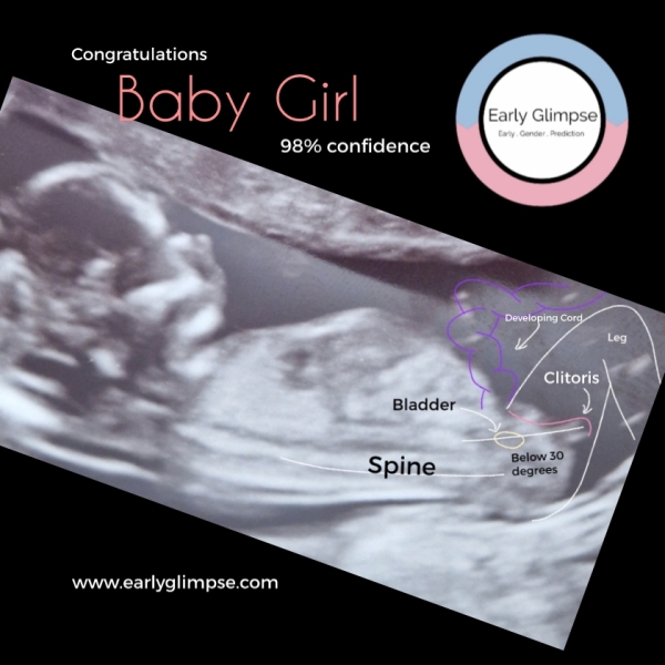 February 2024 Babies 👶 (thread 3)