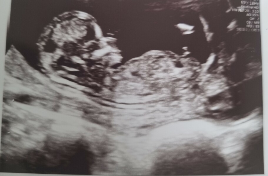 gender prediction... impatient!