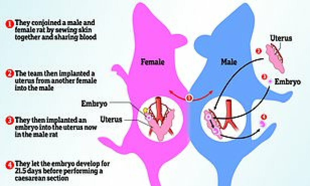Should Uterus Transplantation for Transwomen and Transmen Be Subsidized?