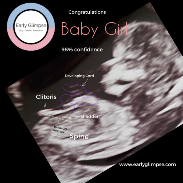 February 2024 Babies 👶 (thread 3)