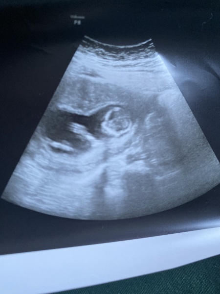 February 2024 Babies 👶 (thread 3)
