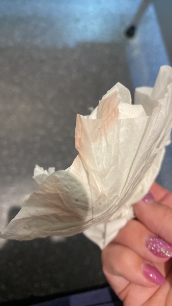 Implantation bleeding?