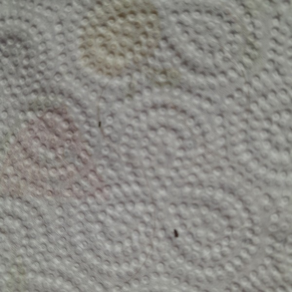 Is this headlice?  Photo attached
