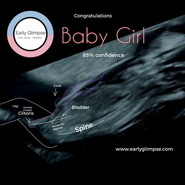 February 2024 Babies 👶 (thread 3)