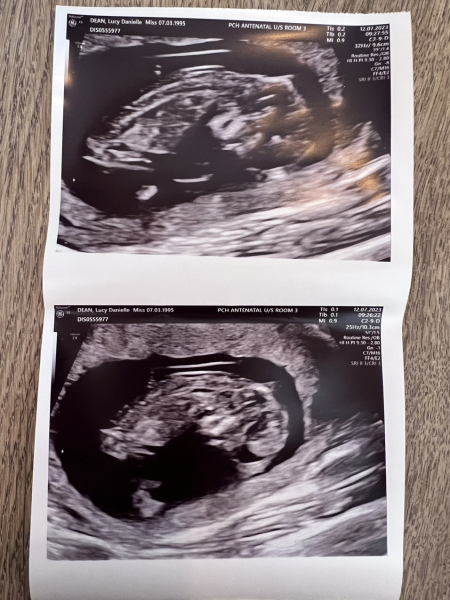 Due January Part 5 🎉