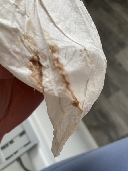**TW GROSS PIC** worried about brown discharge