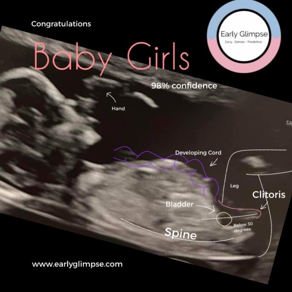 February 2024 Babies 👶 (thread 3)