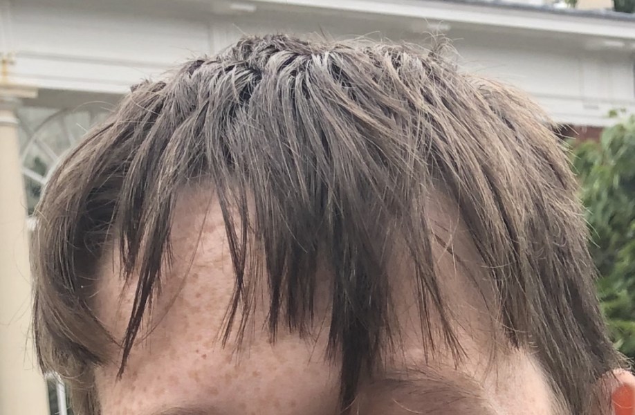 Anyone know why my sons hair grows like this?