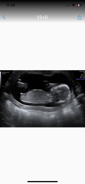 February 2024 Babies 👶 (thread 3)