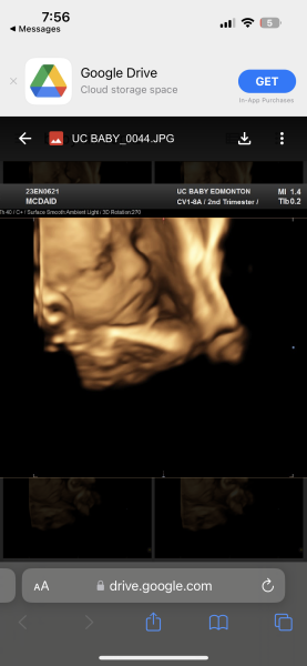 November 2023 babies - thread 4