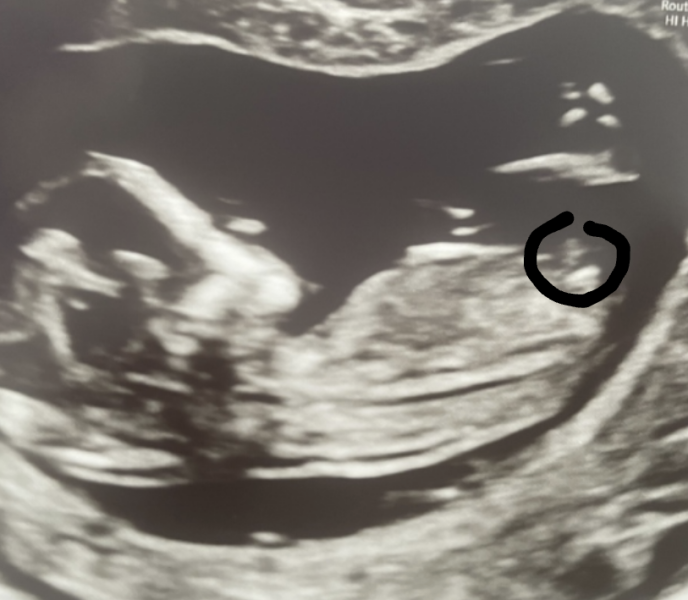 Any nub experts know if a nub is visible 🥰