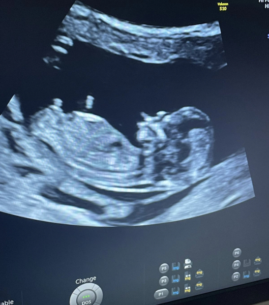 February 2024 Babies 👶 (thread 3)
