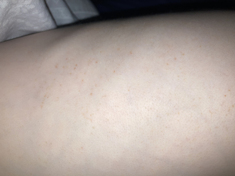 DS(6) has little brown pinpricks on his side
