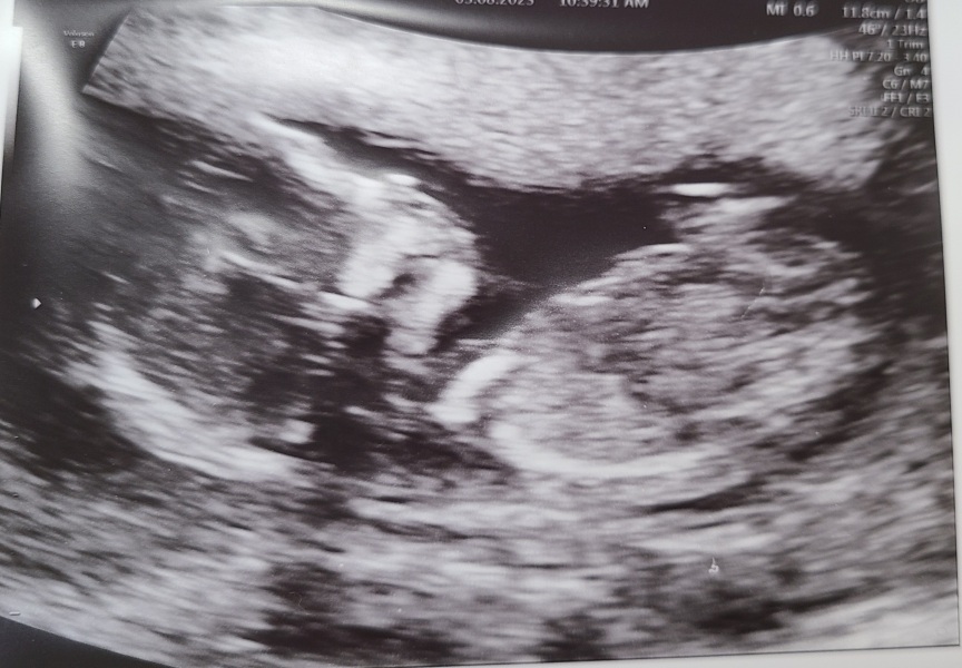 February 2024 Babies 👶 (thread 3)