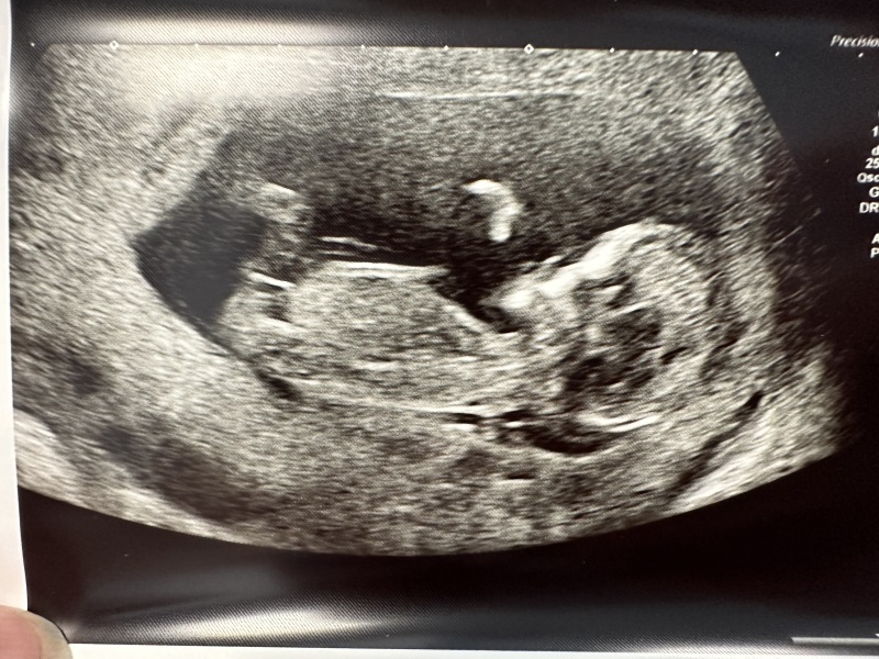 Trying to conceive over 40 part 4