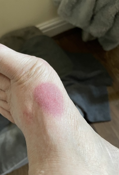 AIBU to be annoyed at these hives