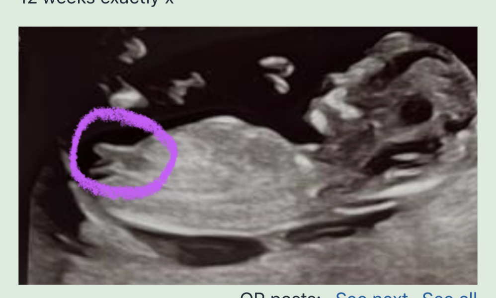 Nub prediction please- I know what I think!