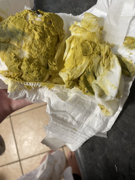 Neocate poo colour?!
