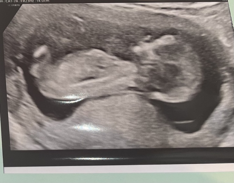 February 2024 Babies 👶 (thread 3)