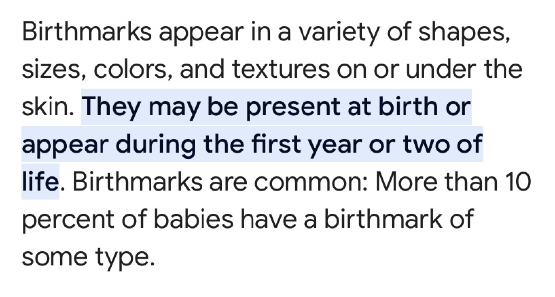Noticed DD's birthmark for the first time today, DH worried it's going to be big