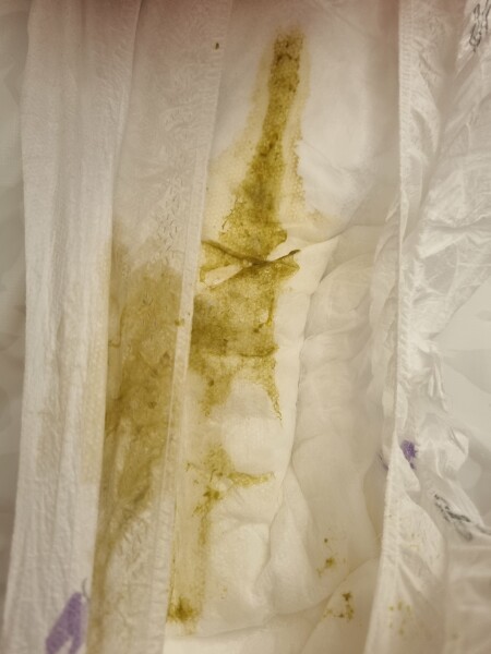 Warning - TMI and pictures - why is baby's poo green?!