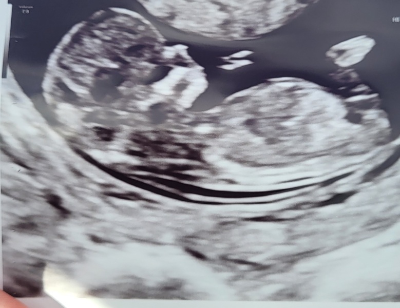 February 2024 Babies 👶 (thread 3)