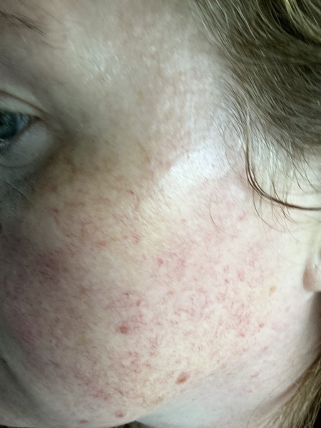 What can I do to improve the appearance of my skin ( photo included)