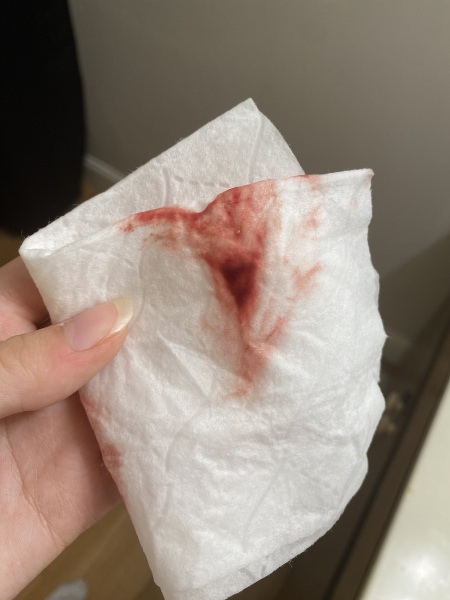 Is this a miscarriage?