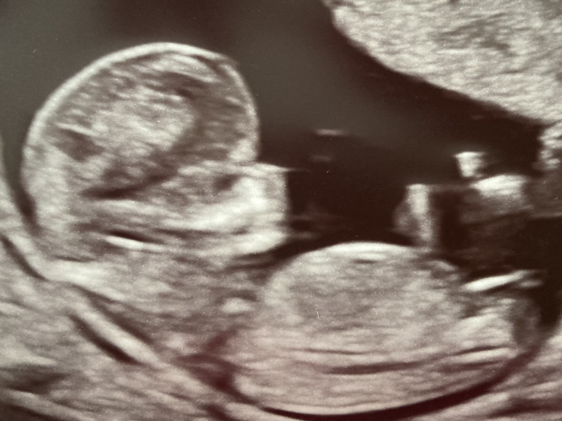 March 2024 continued!