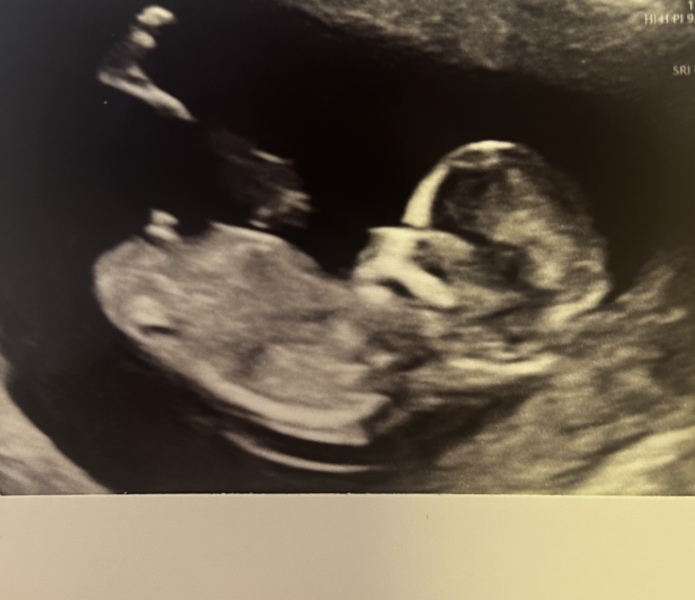 February 2024 Babies 👶 (thread 3)