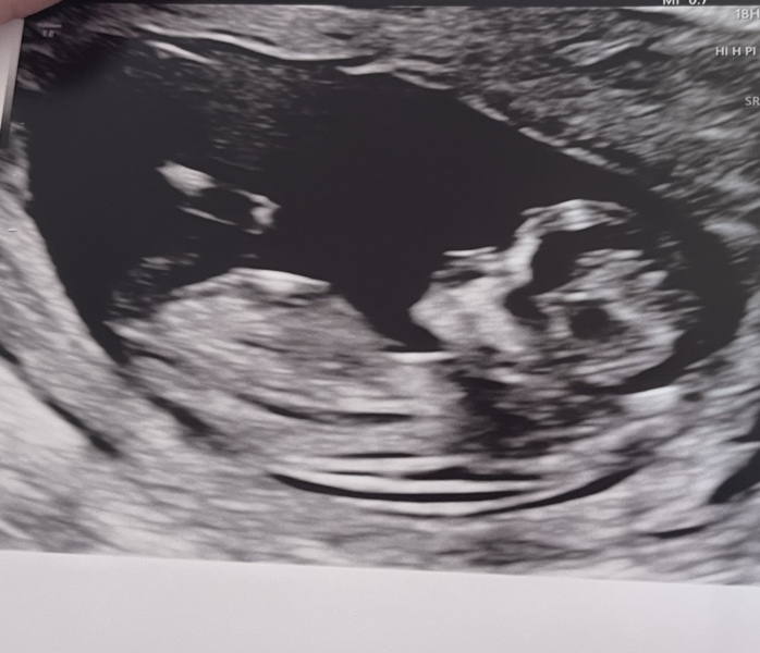 February 2024 Babies 👶 (thread 3)