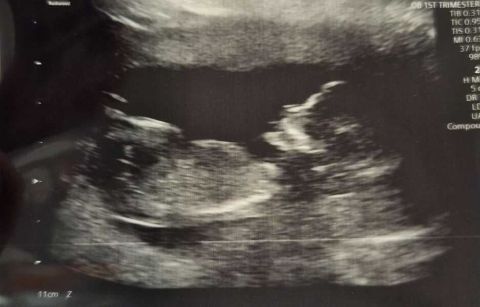 Due January Part 5 🎉