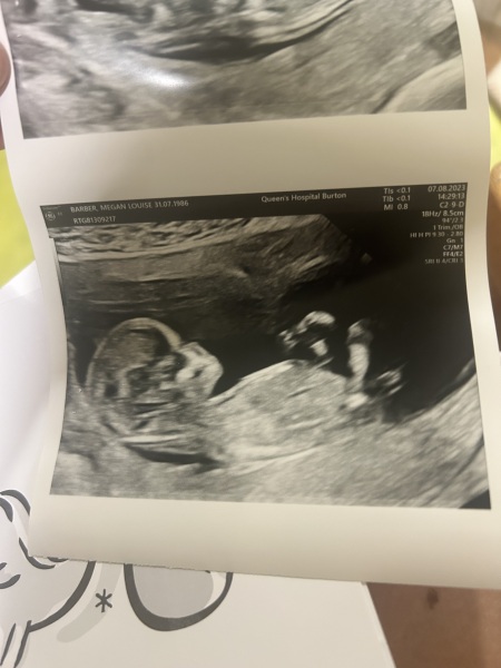 February 2024 Babies 👶 (thread 3)