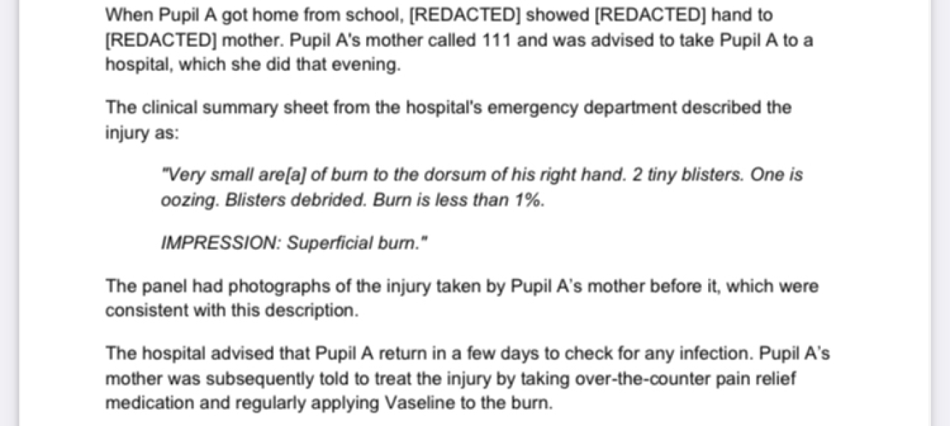 Overreaction about glue gun incident at school