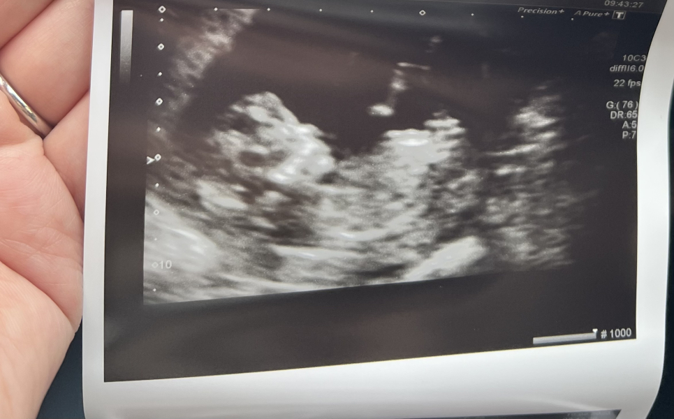 February 2024 Babies 👶 (thread 3)