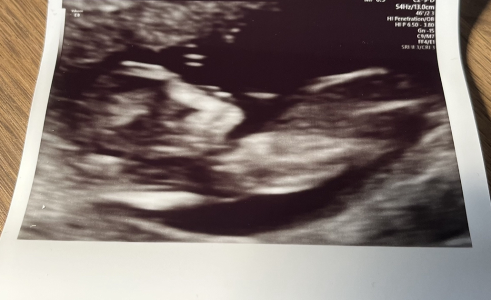February 2024 Babies 👶 (thread 3)