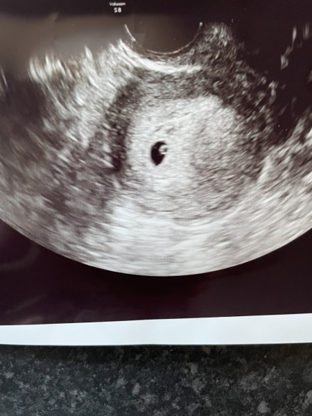 6 weeks