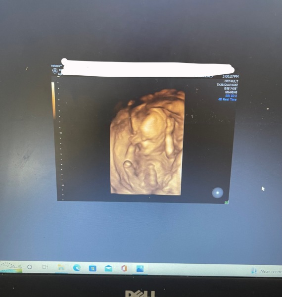 Does my 16 week gender scan look correct?