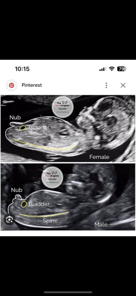 Nub Theory, let’s guess each others!