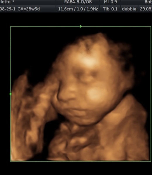 November 2023 babies - Thread 5