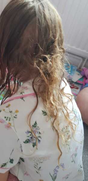 Hard substance stuck in child's hair