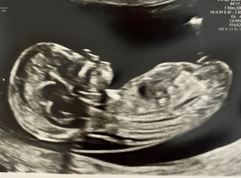 Can you find if it’s  boy or girl?